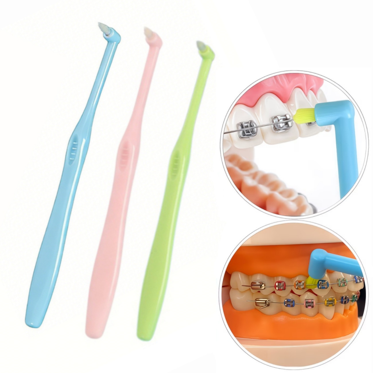 Teeth Whitening With Braces - فرشاة أسنان لتقويم الأسنان برأس مدبب