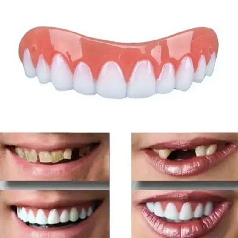 Teeth Whitening With Braces - أسنان اصطناعية جديدة من السيليكون للجزء