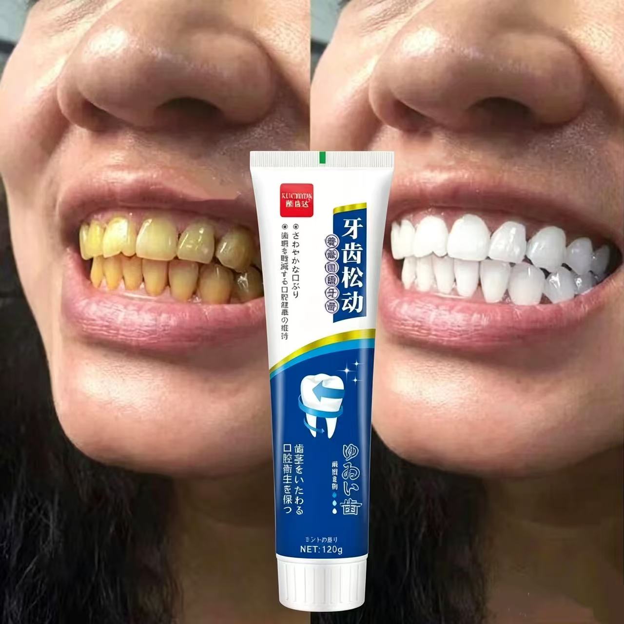 Teeth Whitening Japanese - معجون أسنان ياباني مستورد لعلاج الأسنان
