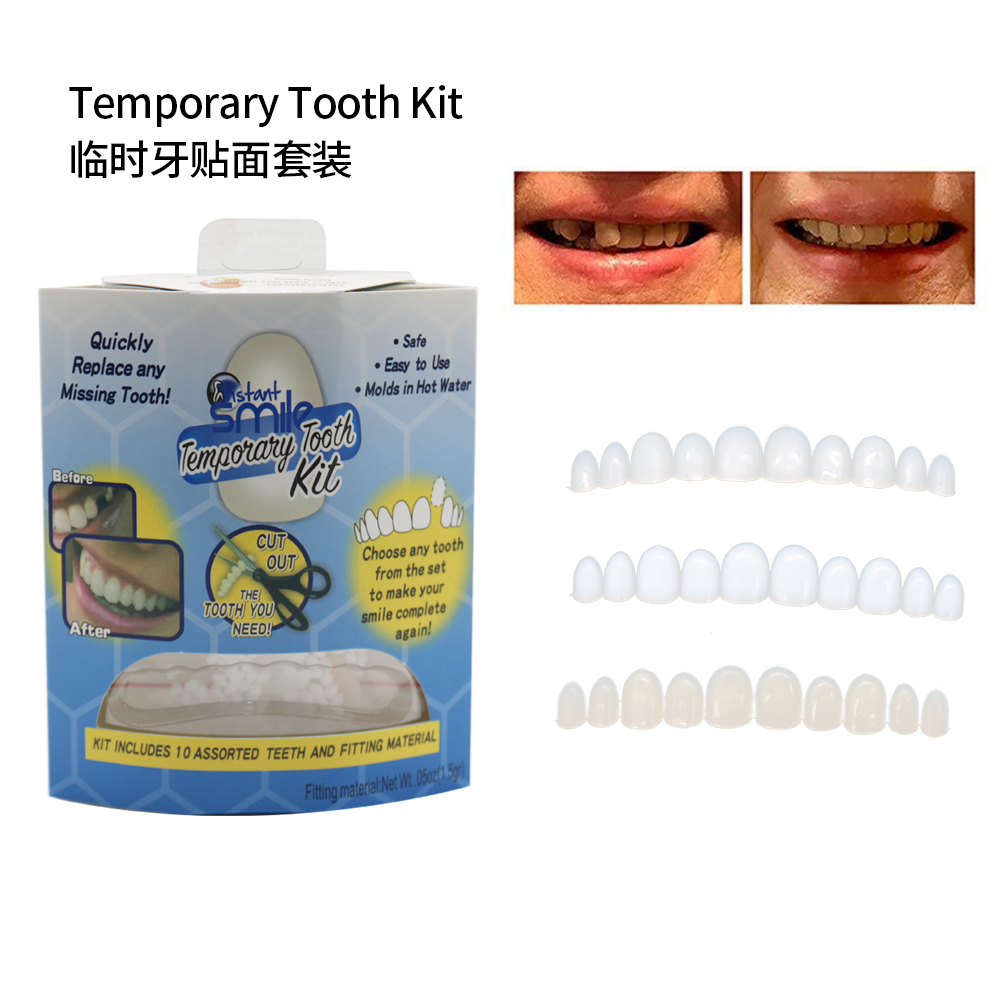 Teeth Whitening With Braces - قشور أسنان مزيفة، دعامة علوية سفلية،
