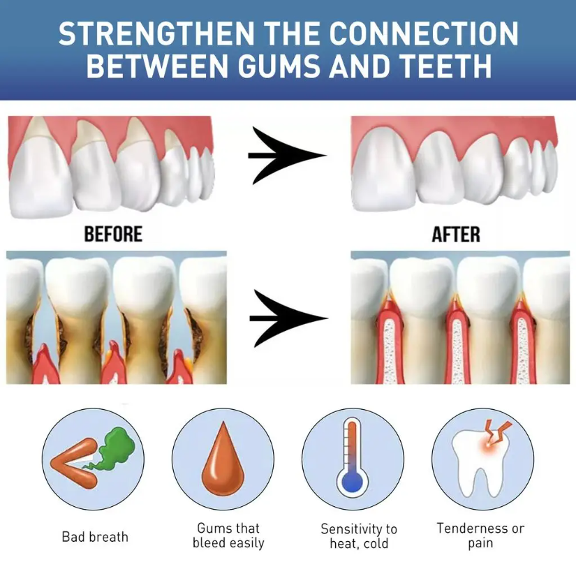 سائل طبيعي للعناية بالفم 60 مل - مراجعة Teeth Whitening Naturally وسعره