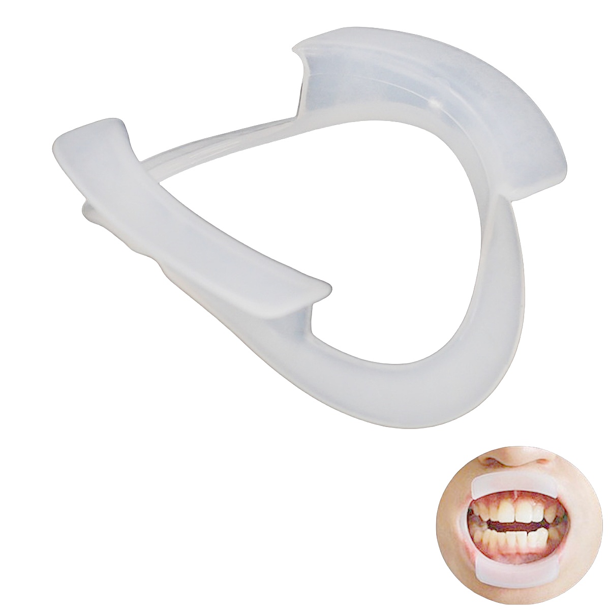100 قطعة/كيس من فتاحات الفم عل - مراجعة Teeth Whitening With Braces وسعره