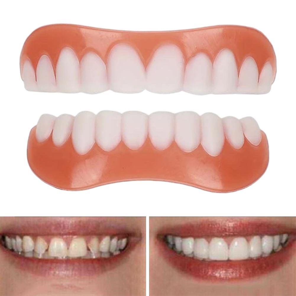 أسنان اصطناعية جديدة من السيلي - مراجعة Teeth Whitening With Braces وسعره