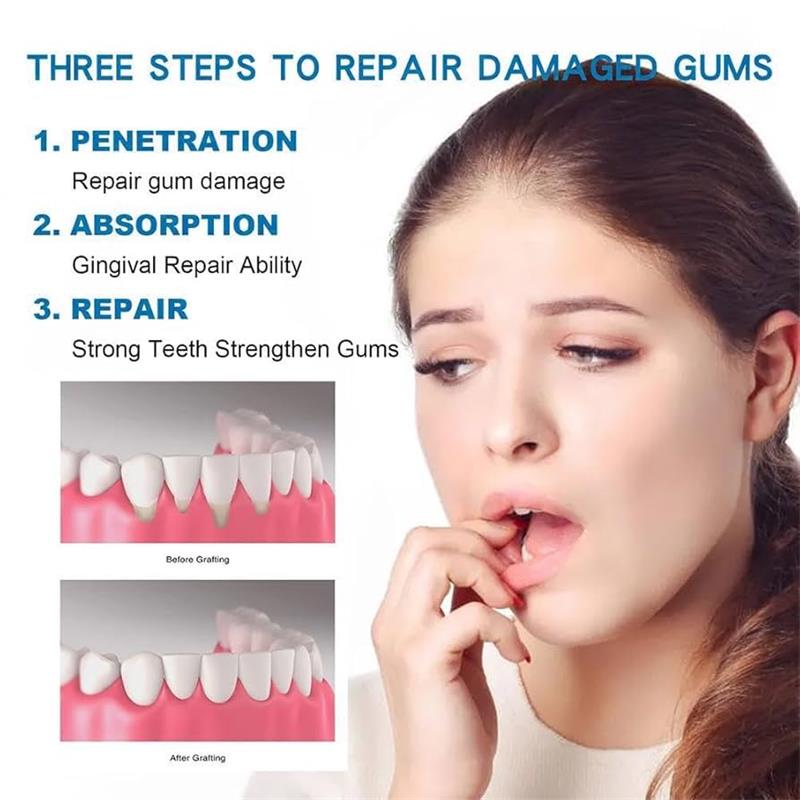 سيروم العناية وإصلاح اللثة لتخ - مراجعة Teeth Whitening Gingival Barrier وسعره