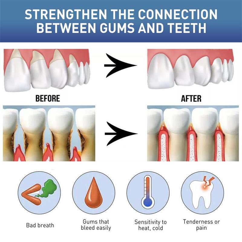 سيروم العناية وإصلاح اللثة لتخ - مراجعة Teeth Whitening Gingival Barrier وسعره