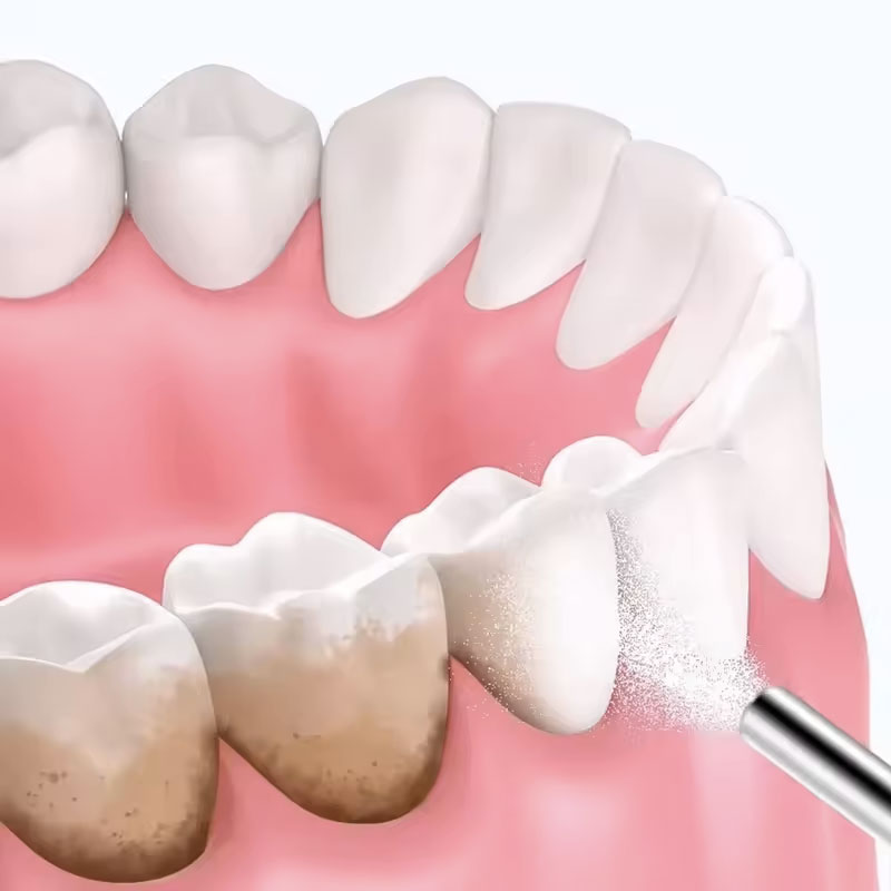 مسحوق تبييض الأسنان بالرمل 130 - مراجعة Teeth Whitening Zimba وسعره