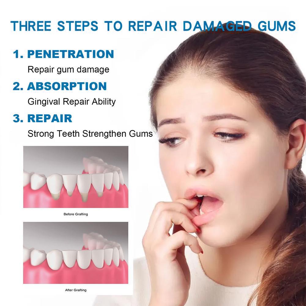 معجون أسنان للعناية بالأسنان،  - مراجعة Teeth Whitening Naturally وسعره