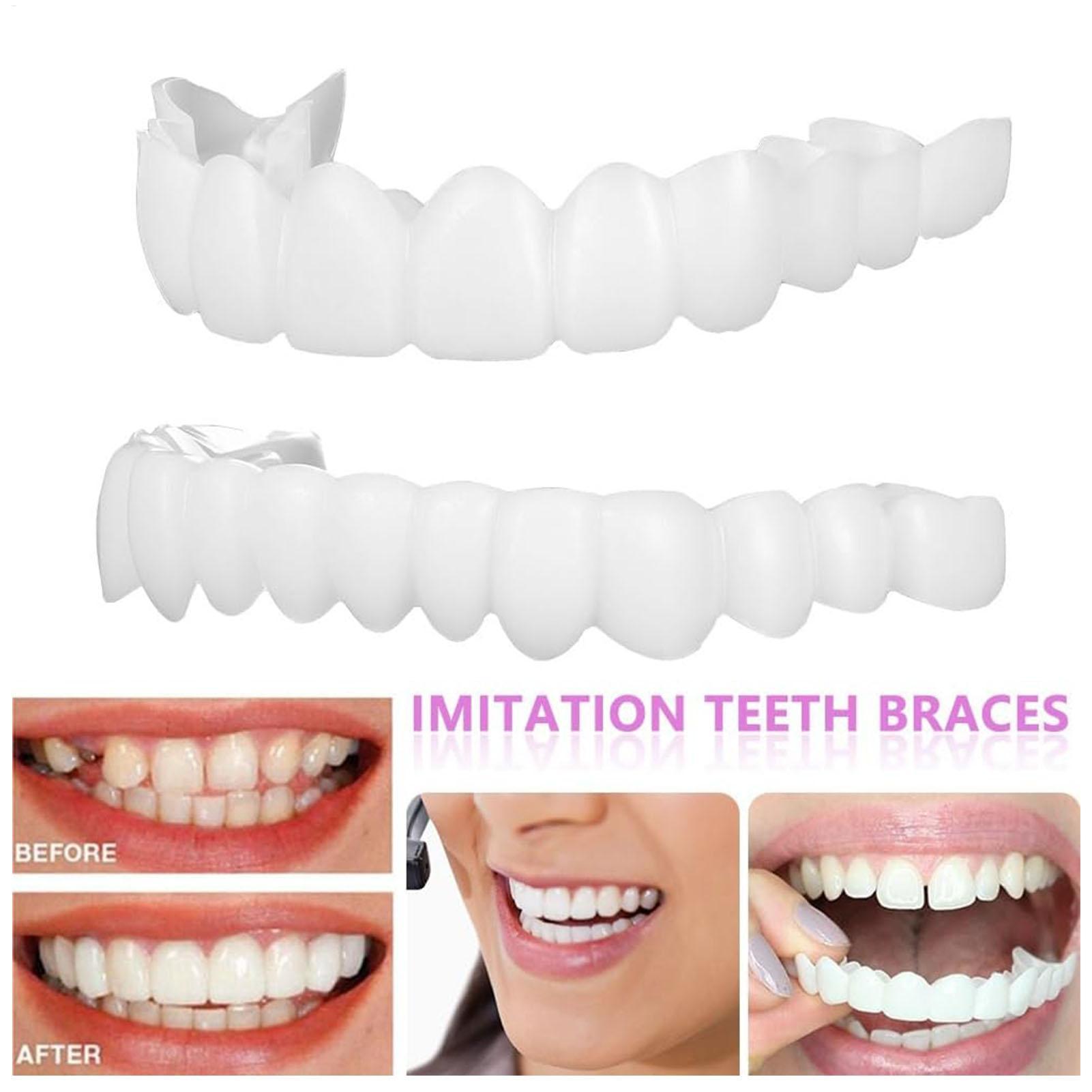 1 زوج SnapsOn قشرة الأسنان اشر - مراجعة Teeth Whitening Mask وسعره