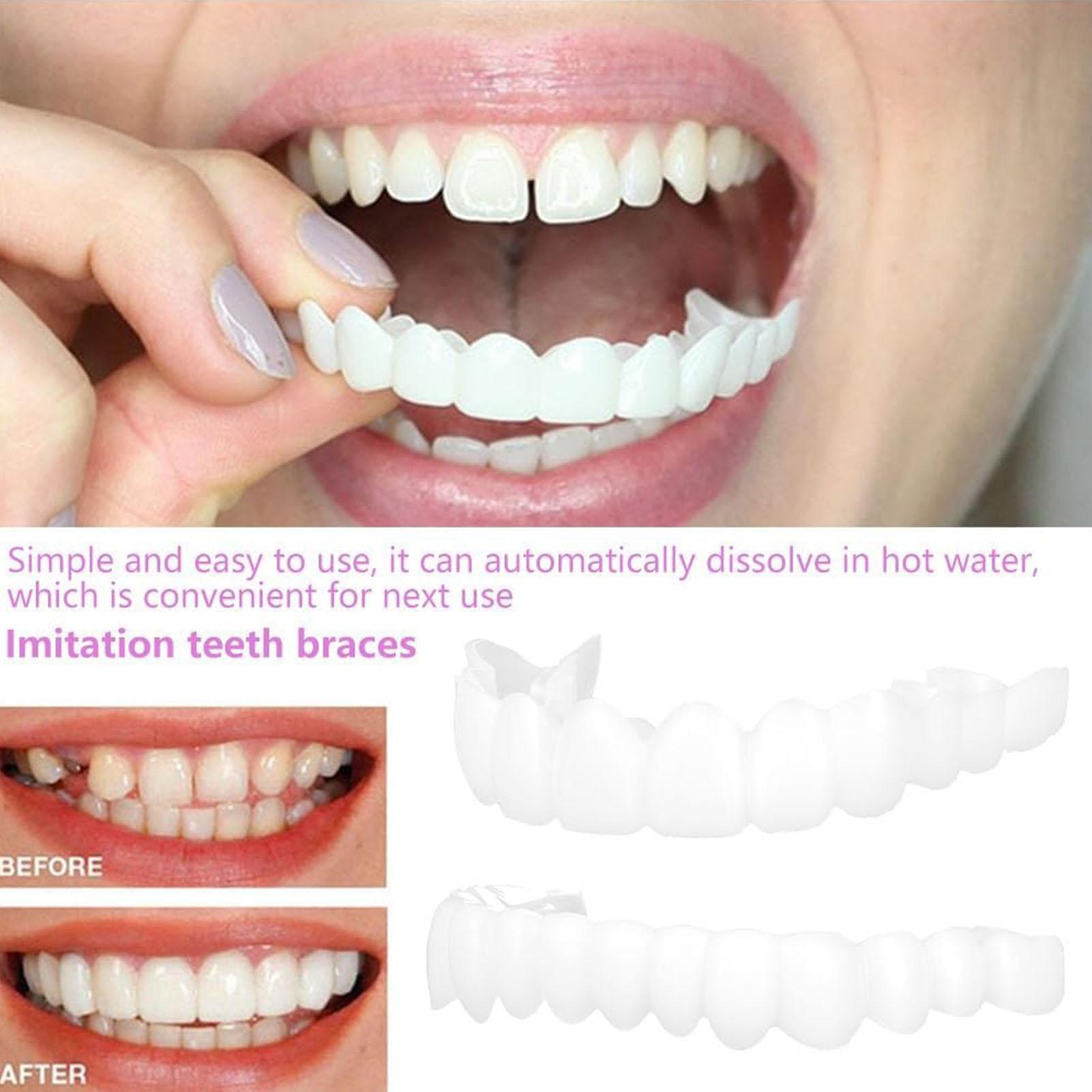 1 زوج SnapsOn قشرة الأسنان اشر - مراجعة Teeth Whitening Mask وسعره